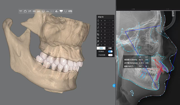 Software de planificación del tratamiento con IA